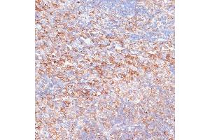 Immunohistochemistry of paraffin-embedded mouse spleen using G3BP1 antibody (ABIN7267528) at dilution of 1:100 (40x lens).