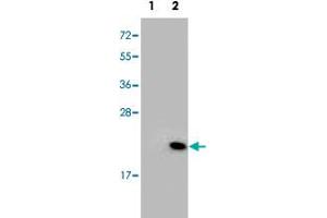 Western blot analysis of RFK (arrow) using RFK polyclonal antibody . (Riboflavin Kinase anticorps  (N-Term))