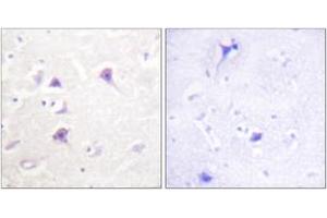 Immunohistochemistry analysis of paraffin-embedded human brain tissue, using HER4 (Ab-1284) Antibody. (ERBB4 anticorps  (AA 1250-1299))