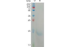 Human C Protein, His Tag on SDS-PAGE under reducing condition.