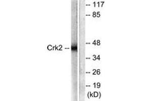 Western blot analysis of extracts from COS7 cells, using CrkII (Ab-221) Antibody. (Crk anticorps  (AA 187-236))