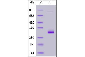 Human VSIG8, His Tag on  under reducing (R) condition. (VSIG8 Protein (AA 22-263) (His tag))