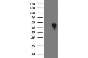 Western Blotting (WB) image for anti-Spermine Synthase, SMS (SMS) antibody (ABIN1501091) (SMS anticorps)