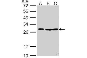 WB Image Sample (30 ug of whole cell lysate) A: 293T B: Molt-4 , C: Raji 12% SDS PAGE antibody diluted at 1:500 (SFRS9 anticorps  (Center))