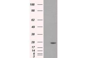 Image no. 4 for anti-Dicarbonyl/L-Xylulose Reductase (DCXR) antibody (ABIN1497785) (DCXR anticorps)