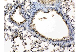 Periplakin was detected in paraffin-embedded sections of mouse lung tissues using rabbit anti- Periplakin Antigen Affinity purified polyclonal antibody (Catalog # ) at 1 µg/mL.