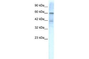 WB Suggested Anti-KCND3 Antibody Titration:  1.