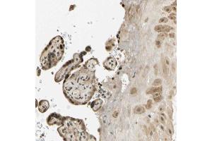 Immunohistochemical staining (Formalin-fixed paraffin-embedded sections) of human placenta with FGF3 polyclonal antibody  shows strong nuclear and cytoplasmic positivity in trophoblastic cells and moderate cytoplasmic positivity in decidual cells.