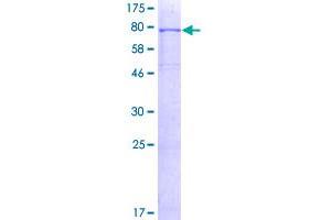 Image no. 1 for Activin Receptor Type I (ACRV1) (AA 1-509) protein (GST tag) (ABIN1305799)