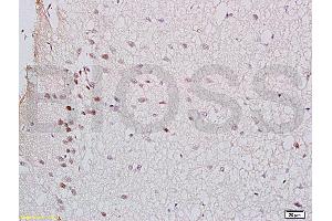 Formalin-fixed and rat brain tissue labeled with Anti-GTPBP10 Polyclonal Antibody (ABIN750748), Unconjugated at 1:200 followed by conjugation to the secondary antibody and DAB staining (GTPBP10 anticorps  (AA 151-250))