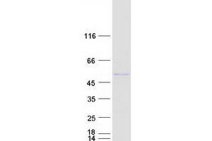 Validation with Western Blot