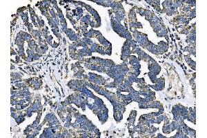 IHC analysis of TOMM70 using anti-TOMM70 antibody (ABIN7599855). (TOM70 anticorps  (AA 122-608))