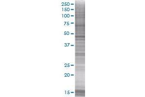 FEN1 transfected lysate. (FEN1 293T Cell Transient Overexpression Lysate(Denatured))