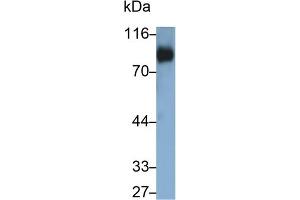 Detection of CD42d in Human Platelet lysate using Polyclonal Antibody to Cluster of Differentiation 42d (CD42d) (GP5 anticorps  (AA 17-242))
