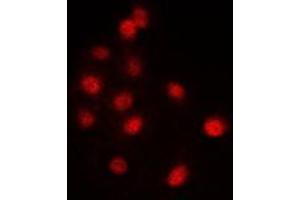 Immunofluorescent analysis of SNRP116 staining in NIH3T3 cells. (EFTUD2 anticorps  (Center))