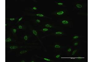Immunofluorescence of monoclonal antibody to TGIF2 on HeLa cell.