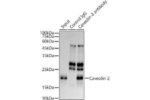 Immunoprecipitation analysis of 300 μg extracts of HeLa cells using 3 μg Caveolin-2 antibody (ABIN7266155).