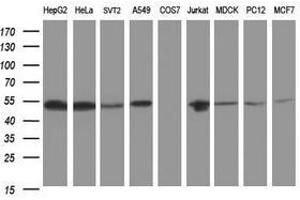 Image no. 3 for anti-CD2 (CD2) antibody (ABIN1497194) (CD2 anticorps)