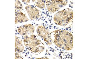 Immunohistochemistry of paraffin-embedded human normal stomach using CHIT1 antibody. (Chitotriosidase 1 anticorps)