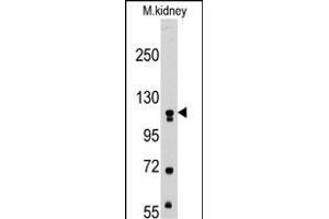 Western blot analysis of anti-MUSK Pab (ABIN392021 and ABIN2841797) in mouse kidney tissue lysates (35 μg/lane). (MUSK anticorps)