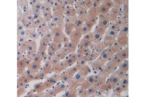 IHC-P analysis of human liver tissue, with DAB staining.