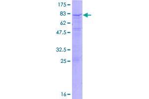 Image no. 1 for Interleukin 17 Receptor C (IL17RC) (AA 1-538) protein (GST tag) (ABIN1307719)