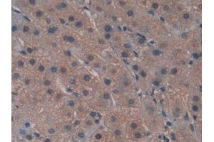 Detection of FZD1 in Human Liver Tissue using Polyclonal Antibody to Frizzled Homolog 1 (FZD1) (FZD1 anticorps  (AA 117-322))