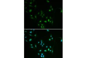 Immunofluorescence analysis of MCF7 cell using BCL2 antibody. (Bcl-2 anticorps)