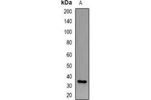 Western blot analysis of CD158i expression in HEK293T (A) whole cell lysates. (KIR2DS4 anticorps)