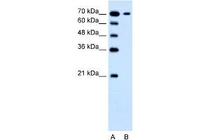 WB Suggested Anti-SLC5A4 Antibody Titration:  1. (SLC5A4 anticorps  (N-Term))