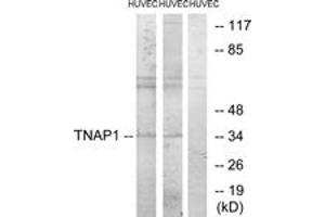 Western blot analysis of extracts from HuvEc cells, treated with PMA 125ng/ml 30', using TNAP1 Antibody. (TNFAIP1 anticorps  (AA 71-120))