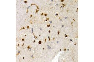 Immunohistochemistry of paraffin-embedded rat brain using SOX2 antibody.