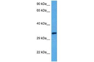 Host:  Rabbit  Target Name:  SLC29A3  Sample Tissue:  Human Uterus Tumor lysates  Antibody Dilution:  1ug/ml