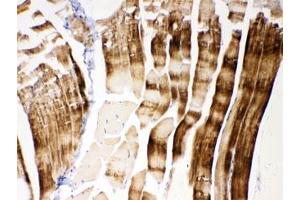 IHC testing of FFPE mouse skeletal muscle with ACTN3 antibody at 1ug/ml.