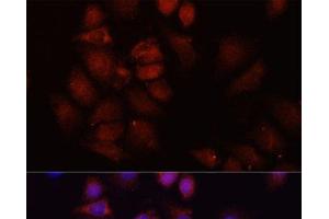 Immunofluorescence analysis of HeLa cells using HRNR Polyclonal Antibody at dilution of 1:100 (40x lens). (HRNR anticorps)