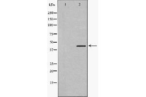 Western blot analysis of Smad7 expression in Human Kidney lysate,The lane on the left is treated with the antigen-specific peptide. (SMAD7 anticorps  (N-Term))