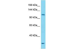 Western Blotting (WB) image for anti-Unc-51 Like Kinase 1 (ULK1) (N-Term) antibody (ABIN2785618) (ULK1 anticorps  (N-Term))