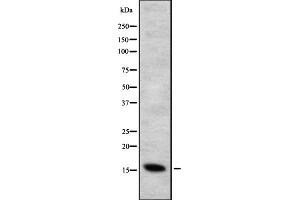 Western blot analysis of CYB5B expression in HEK293 cells ,The lane on the left is treated with the antigen-specific peptide. (CYB5B anticorps  (Internal Region))