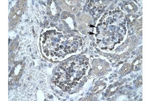 Lipase antibody (Pancreatic) was used for immunohistochemistry at a concentration of 4-8 ug/ml to stain Epithelial cells of renal corpuscle (lndicated with Arrows) in Human Kidney.