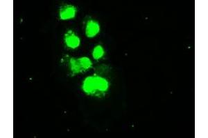 Anti-SSB mouse monoclonal antibody (ABIN2452278) immunofluorescent staining of COS7 cells transiently transfected by pCMV6-ENTRY SSB (RC205013). (SSB anticorps)