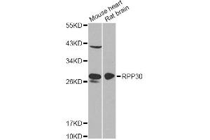 Western blot analysis of extracts of various cell lines, using RPP30 antibody (ABIN6290883) at 1:1000 dilution.