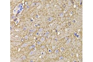 Immunohistochemistry of paraffin-embedded Mouse brain using KCND3 Polyclonal Antibody at dilution of 1:100 (40x lens). (KCND3 anticorps)