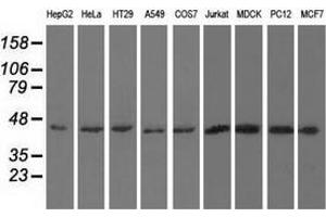 Western blot analysis of extracts (35 µg) from 9 different cell lines by using anti-UHMK1 monoclonal antibody. (UHMK1 anticorps)