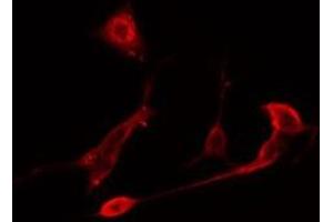 ABIN6275758 staining  NIH-3T3 cells by IF/ICC. (DUSP10 anticorps  (Internal Region))