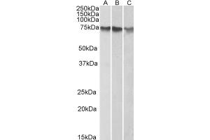 ABIN184639 (1µg/ml) staining of HepG2 (A), K562 (B) and HeLa (C) nuclear lysates (35µg protein in RIPA buffer).