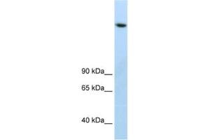 Western Blotting (WB) image for anti-Lysine (K)-Specific Demethylase 3B (KDM3B) antibody (ABIN2461878) (KDM3B anticorps)