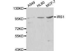 Western blot analysis of extracts of various cell lines, using IRS1 antibody. (IRS1 anticorps)