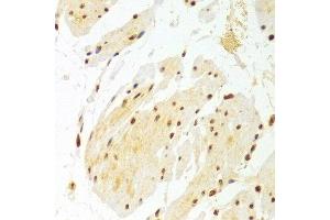 Immunohistochemistry of paraffin-embedded Human esophageal using DKC1 antibody at dilution of 1:100 (x400 lens). (DKC1 anticorps)