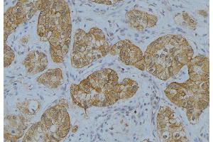 ABIN6273650 at 1/100 staining Human uterus tissue by IHC-P. (IL-13 anticorps  (N-Term))