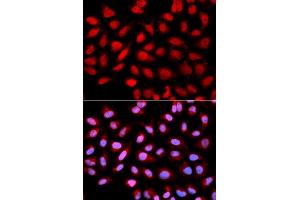 Immunofluorescence analysis of U2OS cells using PPP2R4 antibody (ABIN5970981). (PPP2R4 anticorps)